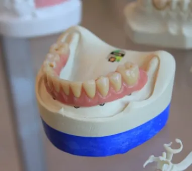 Dental model close-up